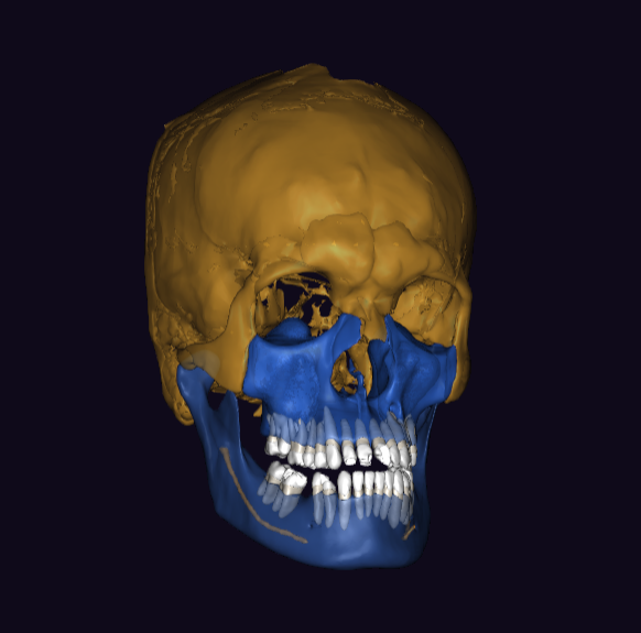 3D снимок черепа