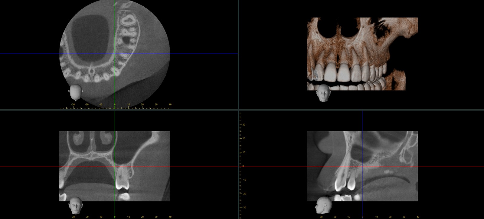 3D снимок сегмента